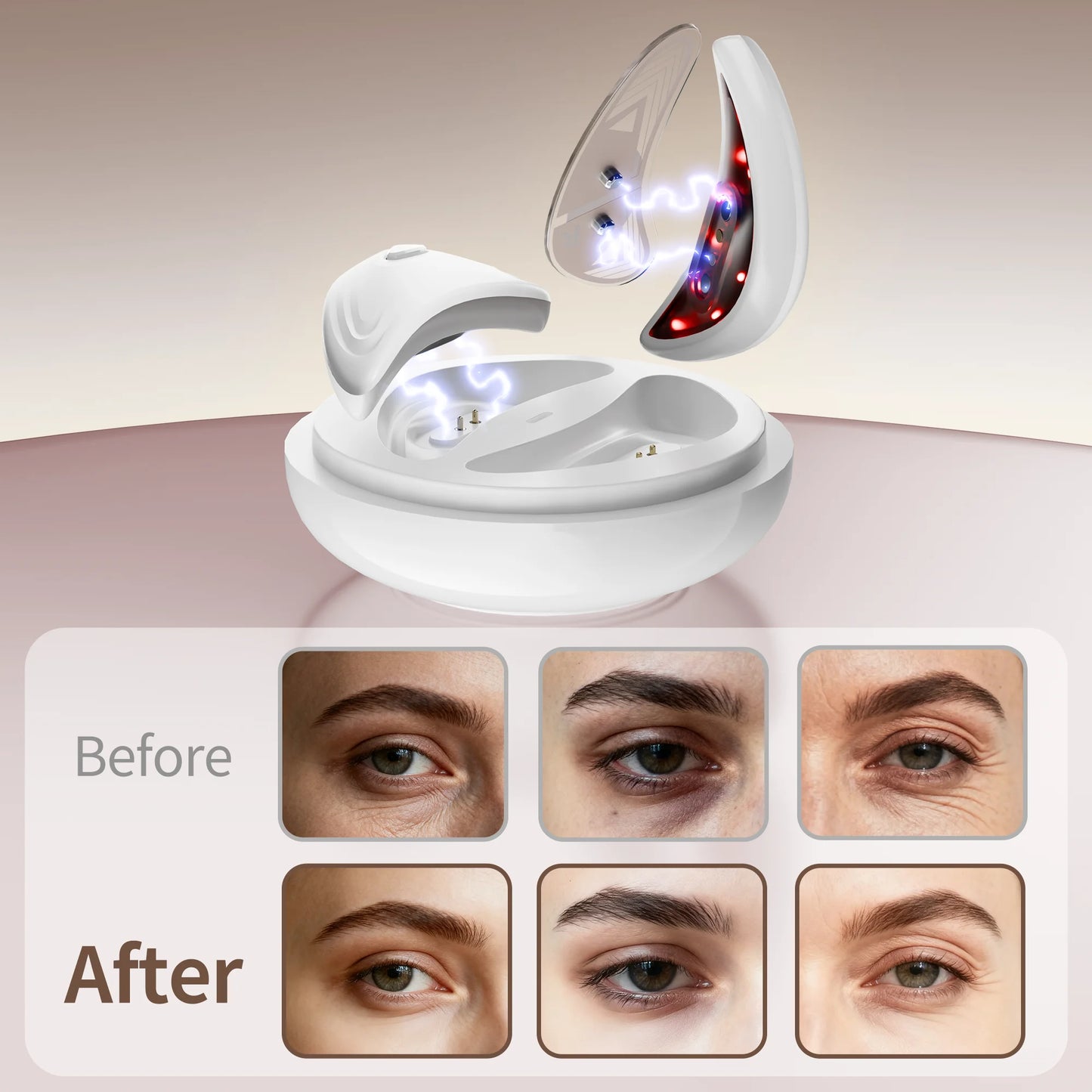 Revitalize Your Eyes with the EMS Redlight Eye Massager: Portable Beauty Device to Reduce Bags & Dark Circles