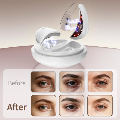 Revitalize Your Eyes with the EMS Redlight Eye Massager: Portable Beauty Device to Reduce Bags & Dark Circles